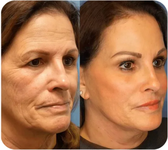 š„ćOfficial Brand StorećInstant face Tightener No-Filter Primer(Limited Time Discount$19.9)