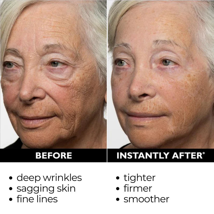 🔥【Official Brand Store】Instant Temporary Face Tightener– 80% OFF!